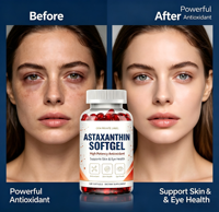 Astaxanthin Softgels Antioksidan Alami Tinggi, Suplemen Makanan Mendukung Kesehatan Kulit & Mata Sehari-hari 120 Kapsul OEM Label Pribadi