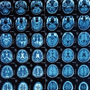 Visionneuse de ligne de production de films radiographiques médicaux industriels à LED développeur ndt - Product Image 2