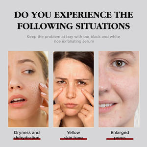 Suero Ampolla de Arroz Negro para Todo Tipo de Piel, Cuidado de la Piel Coreano, Exfoliante Corporal y Facial Blanqueador, Suero de Arroz Exfoliante - Product Image 3