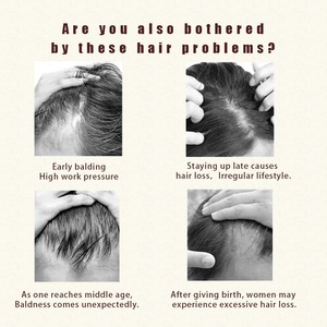 Peignes à cheveux lisses personnalisés avec logo électrique, produits de soin de la peau, traitements de repousse des cheveux, lisseur de cheveux, <span class=keywords><strong>peigne</strong></span> chauffant - Product Image 5