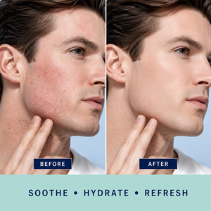 Baume Après-Rasage Hydratant Longue Durée, Formule Rafraîchissante et Apaisante pour Soulager l'Inconfort Après le Rasage, Marque Blanche - Product Image 2
