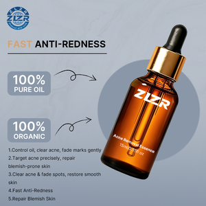 Sérum Anti-Acné 100% Pur et Naturel à Marque Blanche en Gros – Contrôle du Sébum, Éclaircissement des Marques d'Acné, Réparation de la Barrière Cutanée à l'Acide Salicylique - Product Image 5