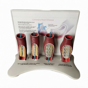 Modelo Anatómico de <span class=keywords><strong>Stent</strong></span> Vascular Humano SMM3192 (PVC) para Educación en Ciencias Médicas - Arteria Coronaria - Product Image 1