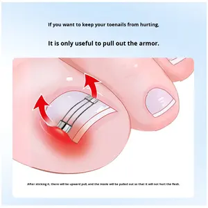 Correcteur d'ongles incarnés <span class=keywords><strong>en</strong></span> acier inoxydable avec <span class=keywords><strong>pince</strong></span> à ressort pour la correction des ongles incarnés Modèle LZ07 - Product Image 4