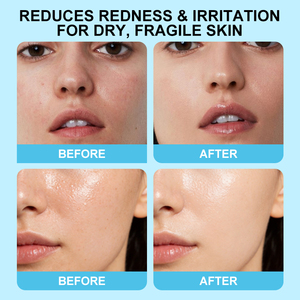 CHIC BEAUTE Bifida Ferment Lysate <span class=keywords><strong>Masque</strong></span> de nuit hydratant en profondeur anti-âge éclaircissant réduisant les ridules pour le visage - Product Image 3