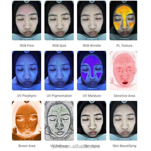 Scanner facial de <span class=keywords><strong>dermatoscope</strong></span> d'analyseur de peau de HD pour diagnostiquer l'équipement de détection de scanner de peau - Product Image 3