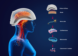 Casco per Terapia a Luce Rossa Suyzeko SSCH con 420 LED 810nm 1070nm, Copertura Completa della Testa, Dispositivo per Alleviare il Dolore e Anti-Infiammatorio - Product Image 3
