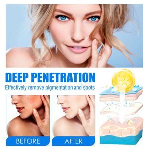 Vente chaude spot éclaircissant crème pour le visage anti-taches mélanine chloasma hydratant hydratant et blanchissant crème pour le visage - Product Image 3