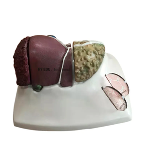 Ciência médica modelo de anatomia do fígado, vasos sanguíneos do fígado, modelo estrutural da bexiga biliar - Product Image 3