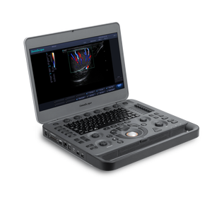 Ecógrafo Doppler Color Veterinario Portátil SonoScape X5V para Caballos, Granjas, Clínicas <span class=keywords><strong>de</strong></span> Animales Pequeños y Hospitales - Product Image 2
