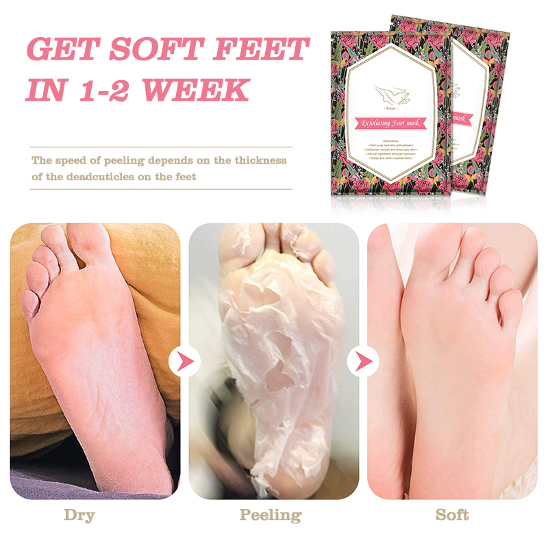 wholesale custom fruits natural foot mask sock peeling moisturizing exfoliating rose foot peel mask
