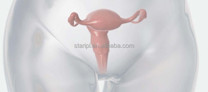 Dispositivos Ginecológicos Portátiles Avanzados para el Tensado Vaginal con Láser de 980nm y 1470nm, Terapia de <span class=keywords><strong>Luz</strong></span> Roja y LED - Product Image 3