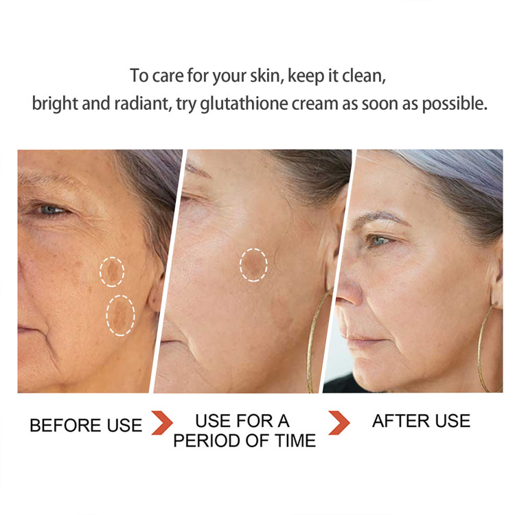 is nad the same as glutathione NAD+ vs Glutathione IV Therapy