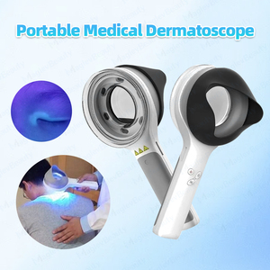 Lámpara de Woods de Alta Calidad para Dermatología, Dermatoscopio con Luz UV, para Diagnóstico de Vitiligo, Psoriasis y Eccema, Analizador de Piel con Luz Ultravioleta - Product Image 3