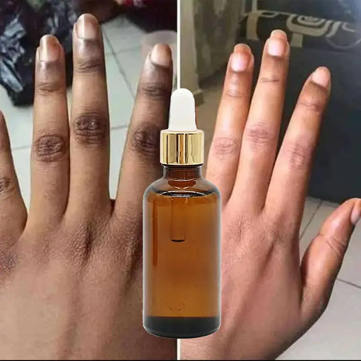 En çok satan OEM hiçbir logo koyu Knuckle renk açıcı Serum dirsek diz parlatma kızdırma cilt bakımı serumu özel etiket renk açıcı Serum