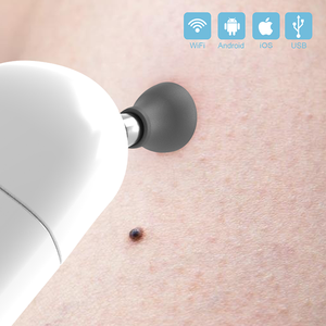 Эндоскопический отоскоп Penguin MSI ENT для осмотра уха человека - Product Image 3