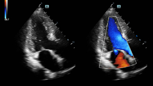 Sistema de Imagenología Digital Veterinaria Avanzado <span class=keywords><strong>Mindray</strong></span> <span class=keywords><strong>DC</strong></span>-<span class=keywords><strong>70</strong></span> <span class=keywords><strong>DC</strong></span>-80 Full HD con Ultrasonido Doppler Color 3D 4D X-Insight para Mascotas - Product Image 6