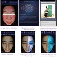 Máquina de Análisis Facial NewFace Pro Dermatology Clinic 3D AI Digital 8 10 Spectrum Multispectral RGB UV PL para Detección de Acné
