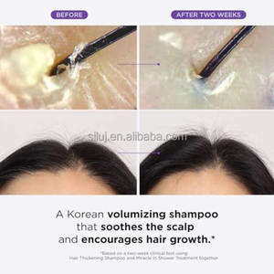Votre Logo Shampooing Épaississant pour Cheveux Soin Capillaire à la Biotine et Huile de Romarin Shampooing à la Biotine - Product Image 3