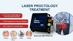 Máquina de Tratamento de Hemorroidas e Fístula Anal a Laser Diode Portátil de Alta Potência 30W+17W 980nm1470nm Mais Recente de 2026 - Product Image 5