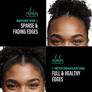 Beurre d'huile de Batana du Honduras 100% biologique en vrac, favorise la croissance des cheveux, répare les cheveux abîmés pour hommes et femmes - Product Image 4