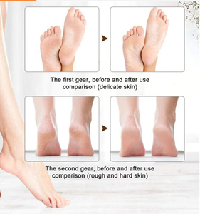 Lime à <span class=keywords><strong>pieds</strong></span> rechargeable, éliminateur de callosités, machine de pédicure, rose, lime à <span class=keywords><strong>pieds</strong></span> électrique, éliminateur de callosités électriques <span class=keywords><strong>pour</strong></span> <span class=keywords><strong>les</strong></span> <span class=keywords><strong>pieds</strong></span> avec lumière LED - Product Image 2