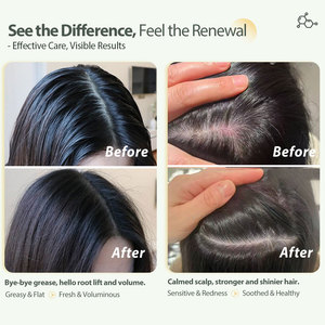 Shampoo crème aux acides aminés très vendu pour cuir chevelu sensible et cheveux abîmés - Rafraîchissant, nettoyage en douceur, nourrissant en profondeur, antipelliculaire - Product Image 2