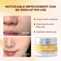 Crème hydratante à l'huile de ricin pour sécheresse sévère |   Crème hydratante intense pour le visage, réparatrice des peaux gercées et squameuses