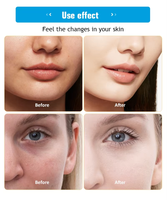 Crème éclaircissante Youbaihu pour les taches brunes, atténue les taches sombres, illumine le teint, unifie le complexion, hydrate et nourrit les peaux ternes et pigmentées