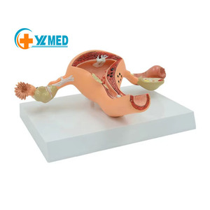 แบบจำลองกายวิภาคศาสตร์สตรี สำหรับการสอนด้านนรีเวชวิทยา แสดงการเปลี่ยนแปลงของมดลูก ทำจากพีวีซี - Product Image 1