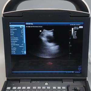 Mesin Ultrasound Veteriner Mindray Dp10 Sonda Enokavitari Mindray Dp10 - Product Image 3