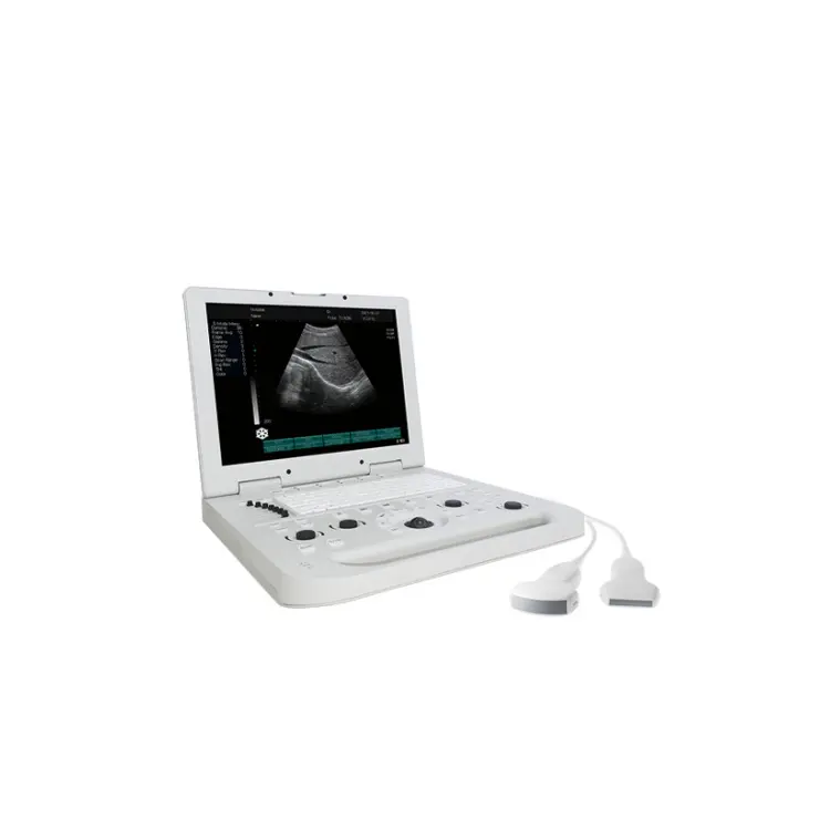 BW taşınabilir ultrasonik makine temel dizüstü 2D BW ultrason tarayıcı makinesi Ruisheng