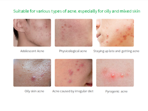 Mụn mụn vá mụn vá, Hydrocolloid mụn hấp thụ tại chỗ Dot 12 24 36 điểm - Product Image 5