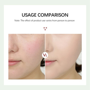 Marque privée Soin de la peau Reparierende Beruhigende <span class=keywords><strong>Creme</strong></span> Réduire les rougeurs Réparateur Crème hydratante pour le visage après le soleil pour femme - Product Image 3