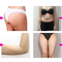 Appareil de massage professionnel à rouleaux internes rotatifs à 360° pour amincir le corps, 350W, 2 poignées, rouleaux internes, réduction de la cellulite