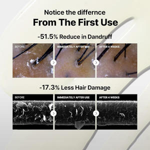 Shampooing <span class=keywords><strong>Ultra</strong></span>-Réparateur et Fortifiant pour <span class=keywords><strong>Cheveux</strong></span> à Base de Peptides, Anti-Chute, Haute Qualité, OEM/ODM, Vente Chaude - Product Image 4