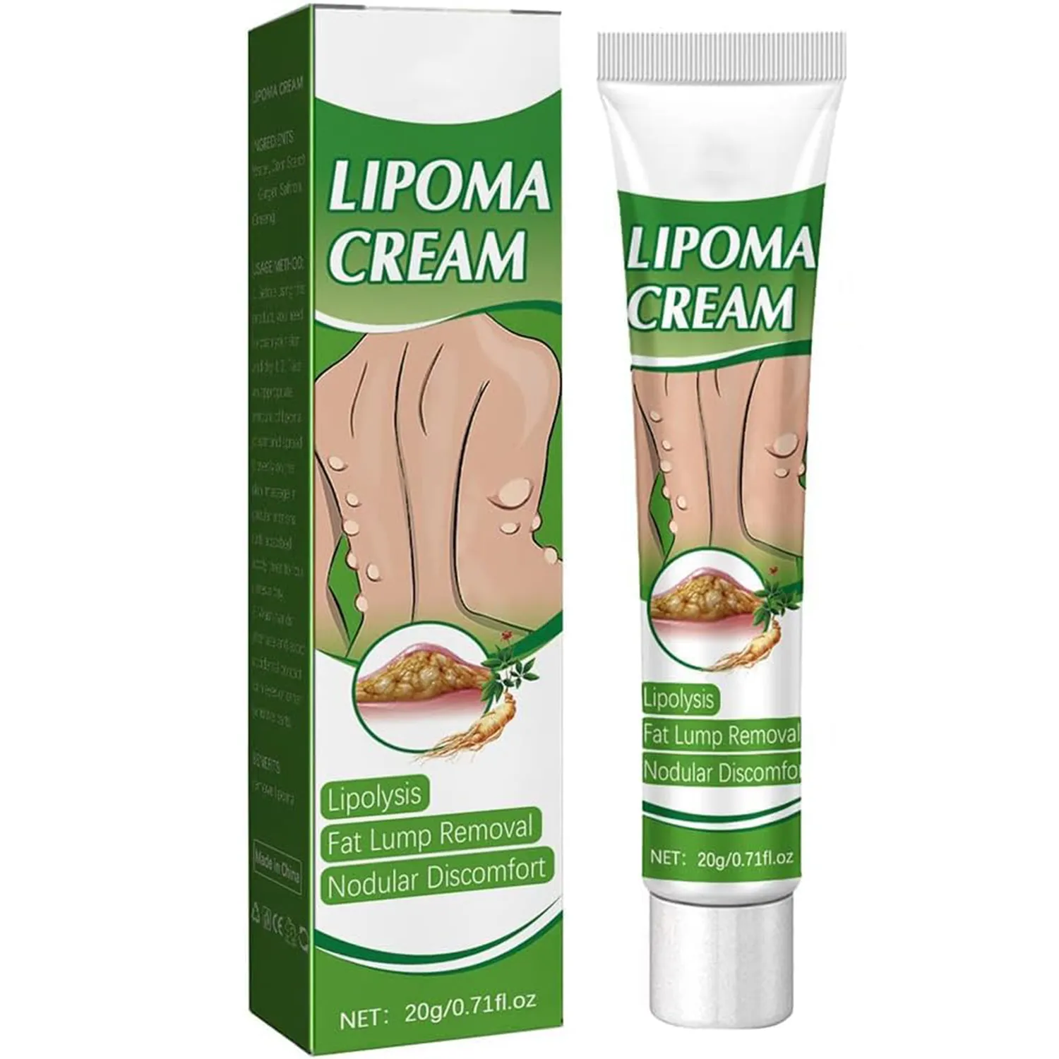 Unguento lenitivo Lipoma, senza grumose, crema antigonfiore per la pelle