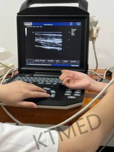 KT-A002 ज़ोनकेयर एम 5 3 डी 4 डी पोर्टेबल चिकित्सा अल्ट्रासोनिक इकोग्राफो पशु पशु पशु पशु चिकित्सा रंग डॉपलर अल्ट्रासाउंड प्रणाली - Product Image 3