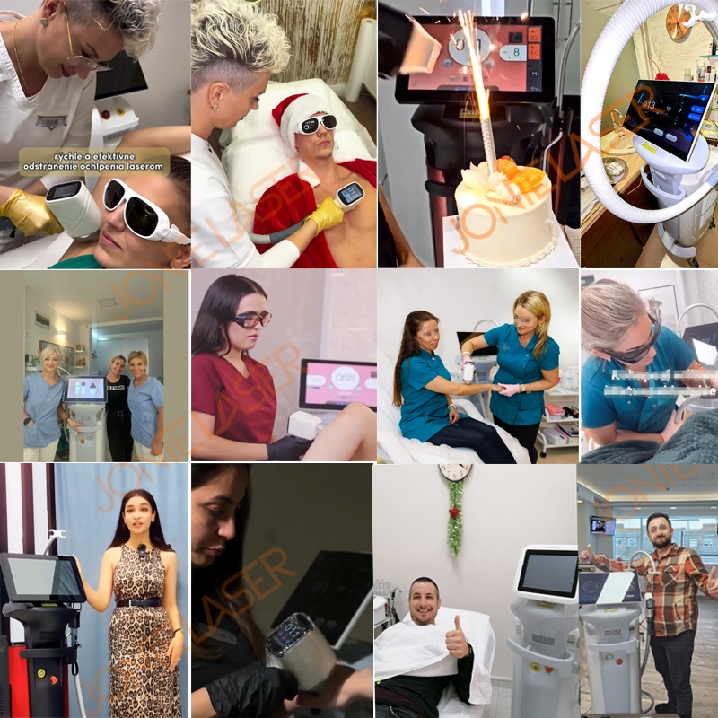 laser hair removal home
