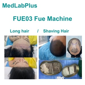 Máquina de Trasplante Capilar FUE, Extracción de Unidades Foliculares FUE y Trasplante de Unidades Foliculares <span class=keywords><strong>FUT</strong></span>, Punch FUE - Product Image 2