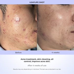 2025 removedor de arrugas masajeador de elevación de cara y cuello uso doméstico equipo de belleza terapia de estiramiento de la piel varita dispositivo antiarrugas - Product Image 6