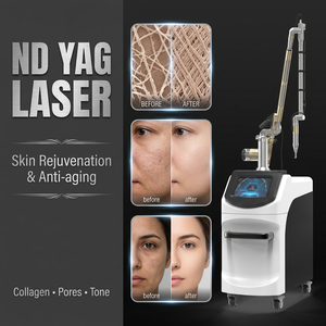 เครื่องเลเซอร์พิโควินาที คิวสวิตช์ Nd Yag สำหรับการแพทย์ อุปกรณ์กระชับผิว เครื่องลบรอยสักบนใบหน้าเพื่อความงาม - Product Image 1