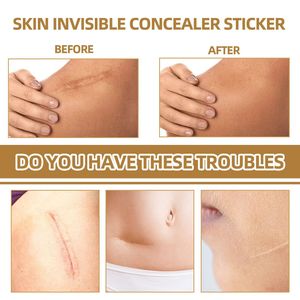 Không thấm nước vô hình chăm sóc vết sẹo vá da giai điệu phù hợp với kem che khuyết điểm cho mụn trứng cá và hình xăm - Product Image 6