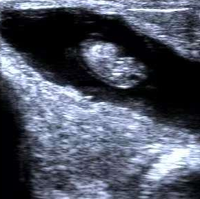 Appareil de surveillance vétérinaire portable, appareil d'échographie pour la diagnostic de la gestation animale