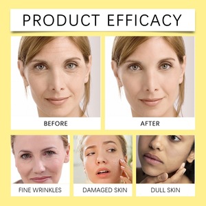 Marque privée biologique 100% naturel nourri à l'herbe boeuf suif fouetté baume au miel produits de soins de la peau faits à la main hydratant baume de suif - Product Image 5