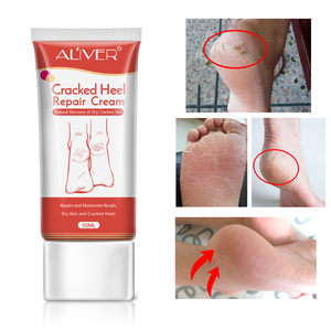 ALIVER-<span class=keywords><strong>Crema</strong></span> de manos y pies para el cuidado de los pies, <span class=keywords><strong>crema</strong></span> <span class=keywords><strong>hidratante</strong></span> de ácido salicólico, anticraqueo seco, piel muerta, <span class=keywords><strong>crema</strong></span> reparadora de talones agrietados, <span class=keywords><strong>20</strong></span>% - Product Image 5