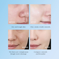 Gel hydratant éclaircissant, crème hydratante blanchissante, anti-âge, niacinamide, capsule de gelée de collagène rose, crème pour le visage