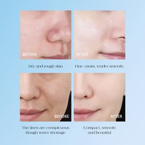 Gel hydratant éclaircissant, crème hydratante blanchissante, anti-âge, niacinamide, <span class=keywords><strong>capsule</strong></span> de gelée de collagène rose, crème pour le visage - Product Image 2