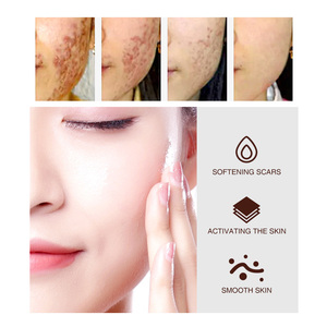 BANXEER mejor de la esencia de la reparación de la piel suero 15 ml suero cuidado de la piel - Product Image 4