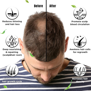 Aceite de botina de suero para el crecimiento del cabello de ricino antipérdida de cabello de etiqueta privada para mujeres negras - Product Image 2